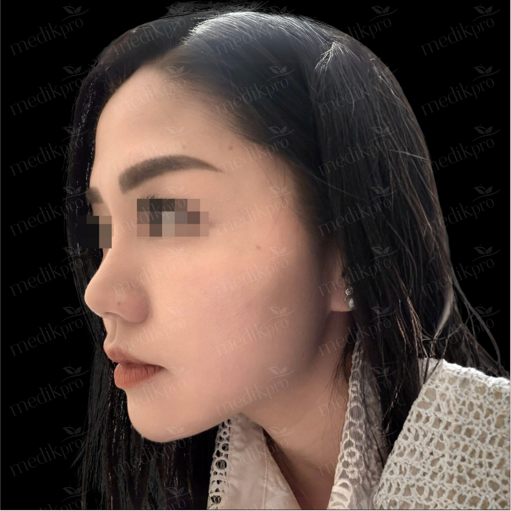Image Before