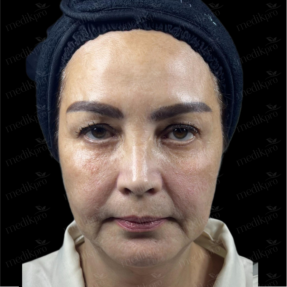 Image After