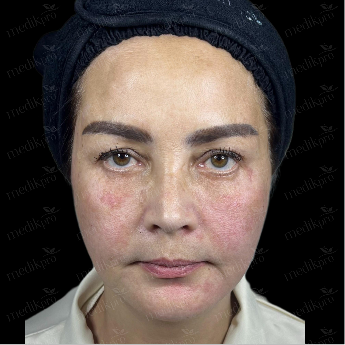 Image Before