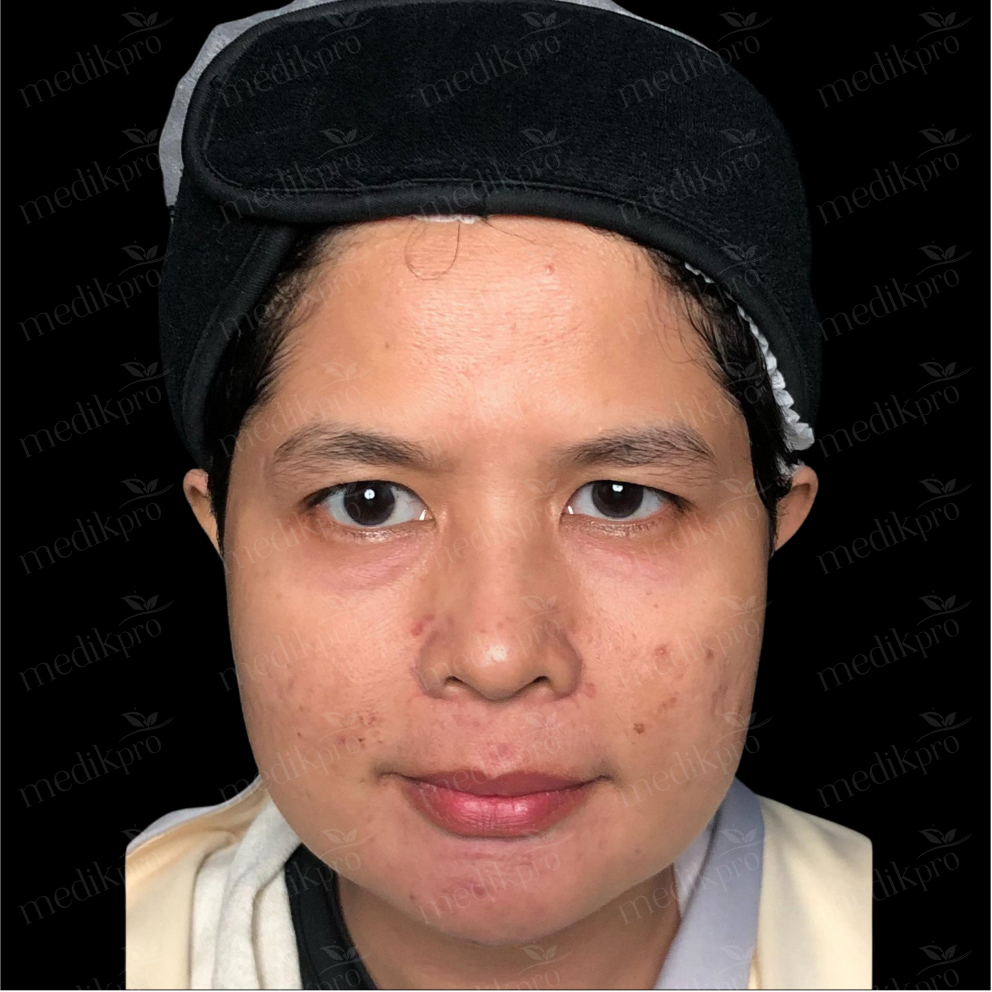 Image After
