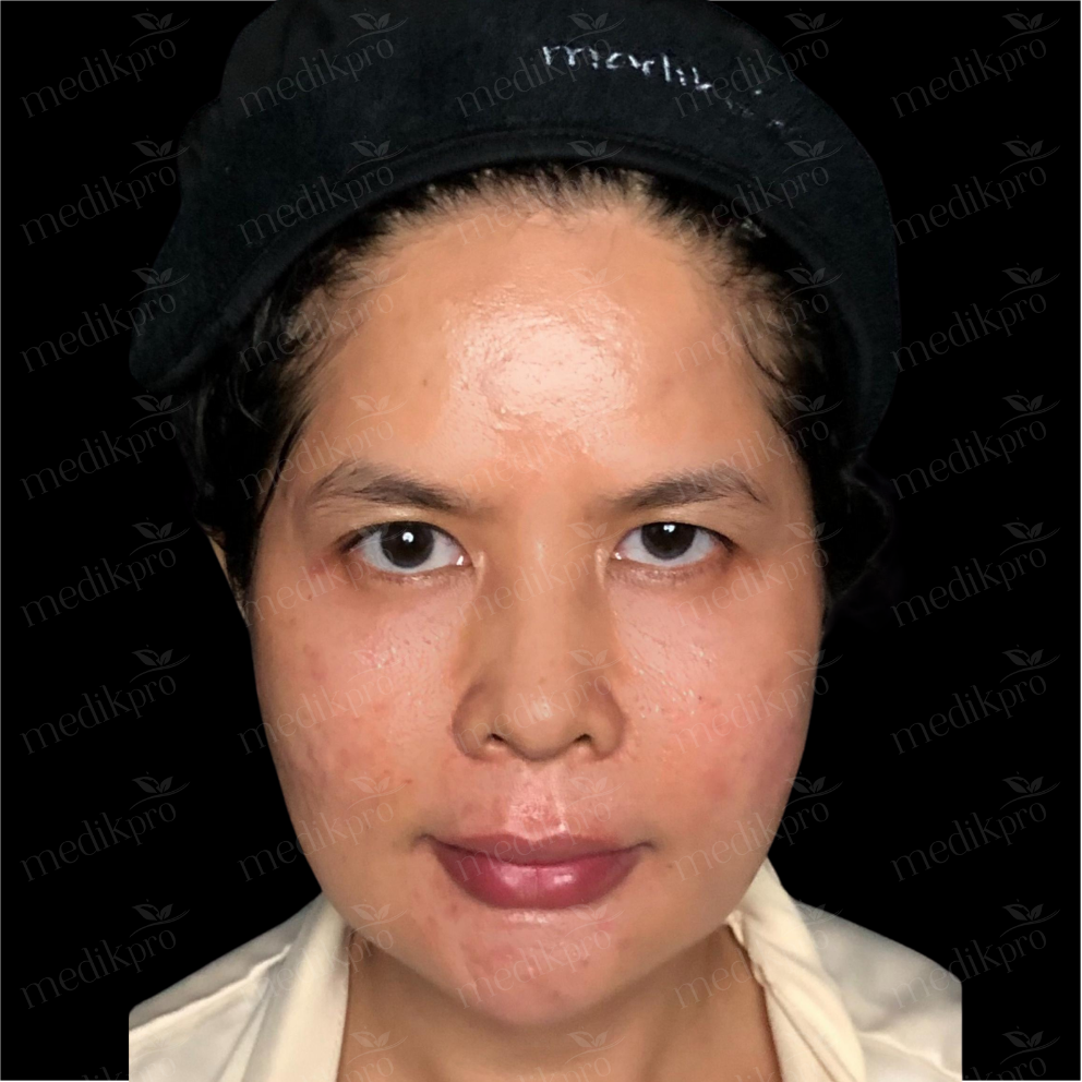 Image Before