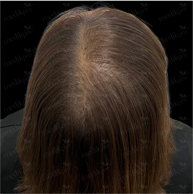 Image Before
