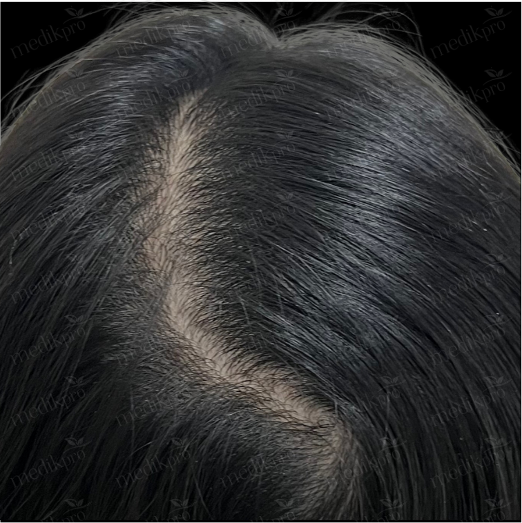 Image Before