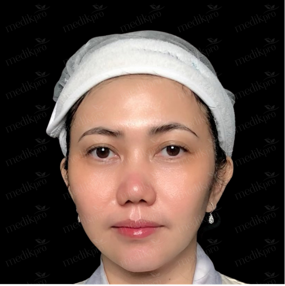 Image Before