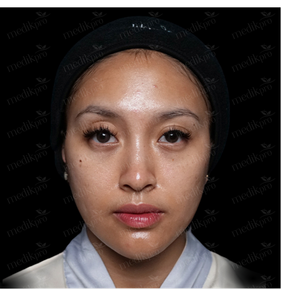 Image Before