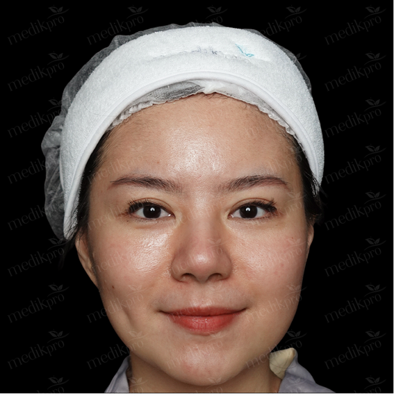 Image Before