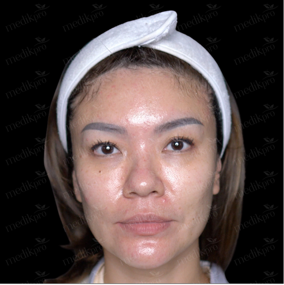 Image Before