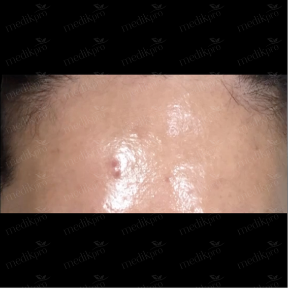 Image Before