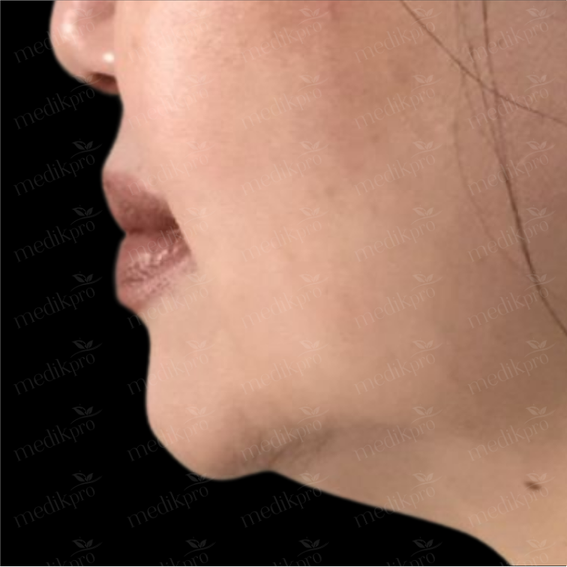 Image After