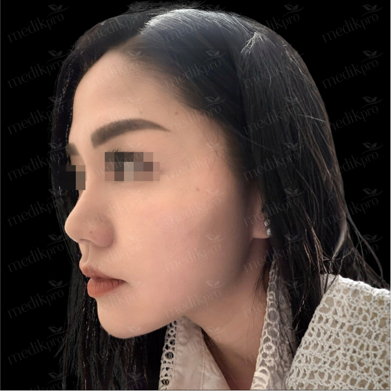 Image Before