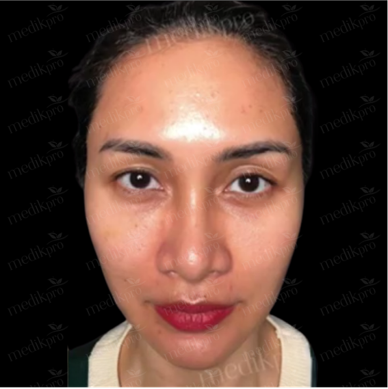 Image Before