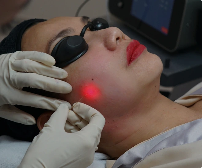 Konsultasikan EndoliftX® di MedikPro Jakarta