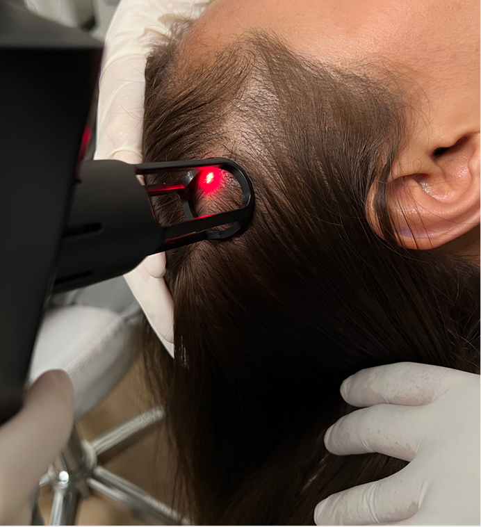 Konsultasikan LightSCAN™ Hair Regrowth di MedikPro Jakarta