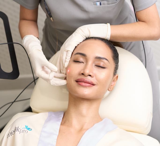 Endolift®